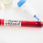 Einladung zur Beratung und Testmöglichkeiten auf Hepatitis C und HIV