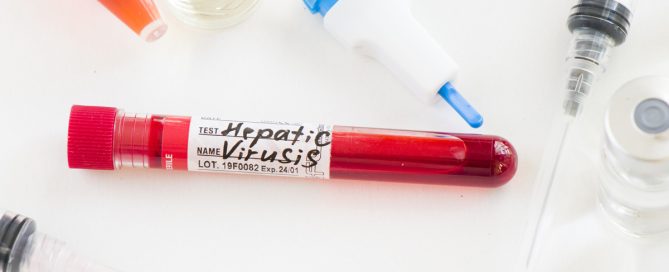Einladung zur Beratung und Testmöglichkeiten auf Hepatitis C und HIV